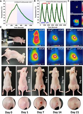 Biodegradable manganese-doped hydroxyapatite antitumor adjuvant as a promising photo-therapeutic for cancer treatment